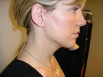 The new me! The scars are still fading.